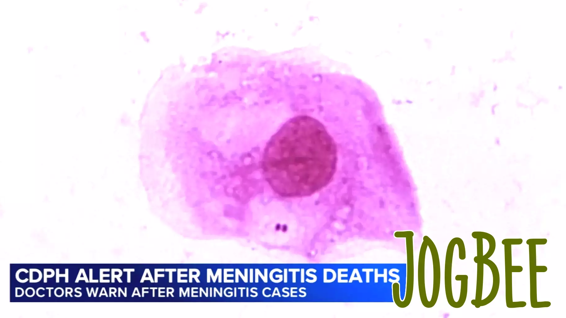 2 deaths, high cases reported in meningitis outbreak, Chicago Department of Public Health warns
