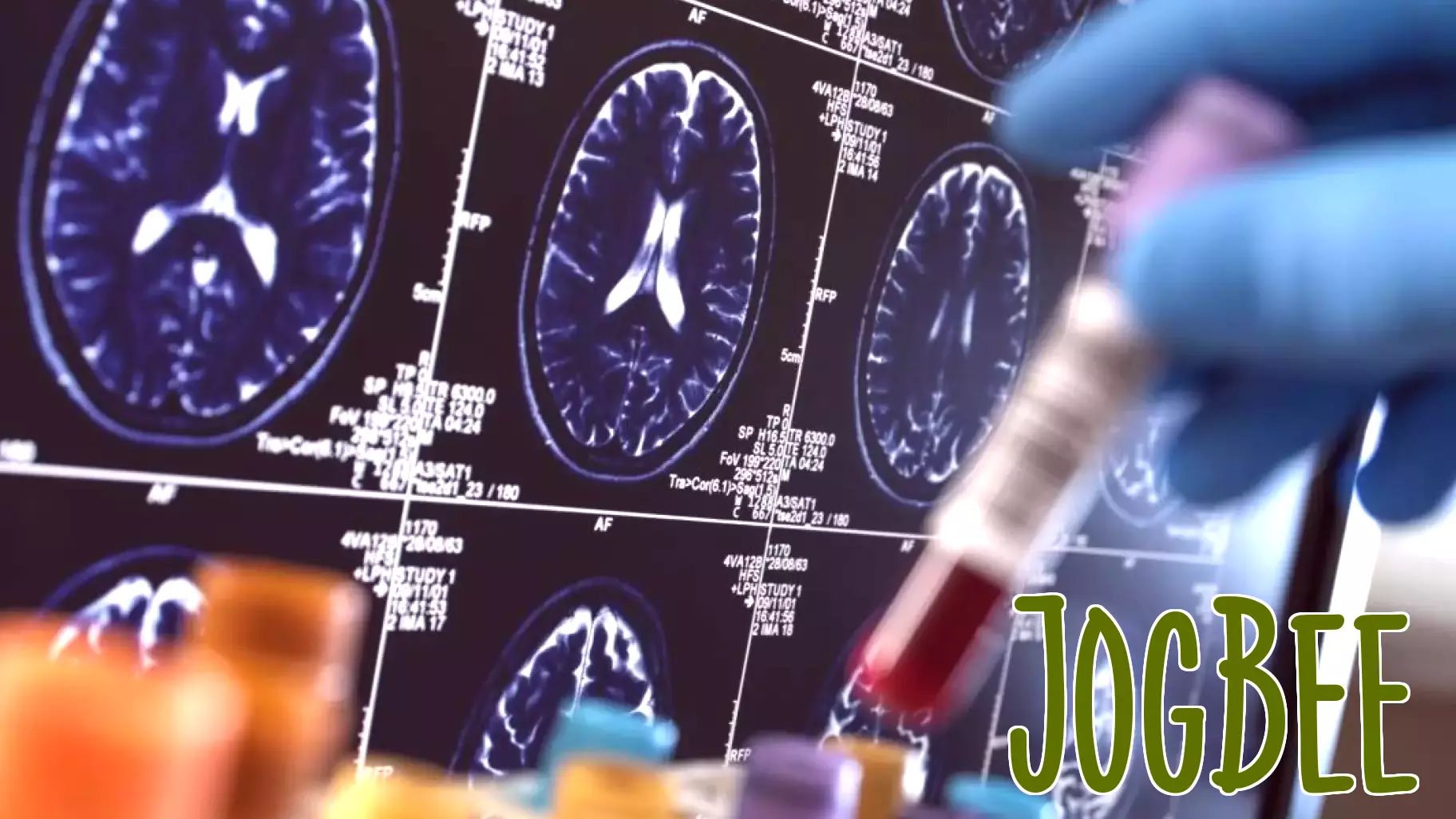 9 in 10 Americans say brain health is important, but Alzheimer’s report finds most don’t know how to maintain it