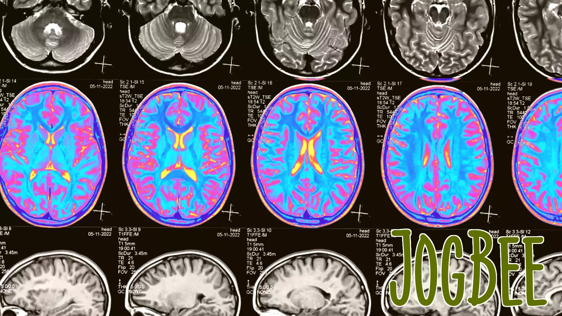 Exploring Health and Identity Through Personal Narrative