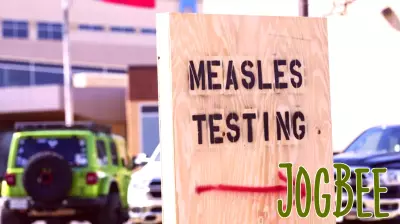 Measles Outbreak: 1,001 Cases Reported Across 11 States