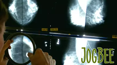 Penn study finds GLP-1 use associated with lower breast cancer risk; researchers to launch clinical trial