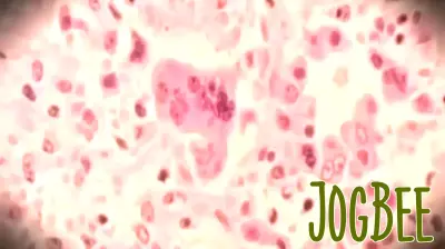 Potential Measles Exposure at Newark Airport